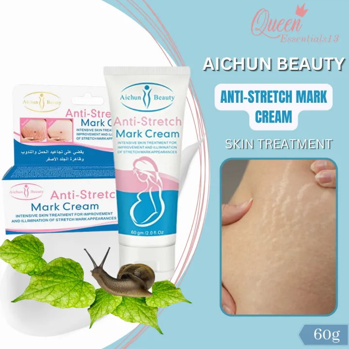 Anti Stretch Mark Cream