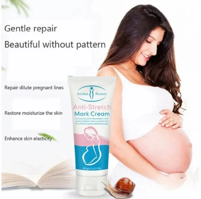 Anti Stretch Mark Cream