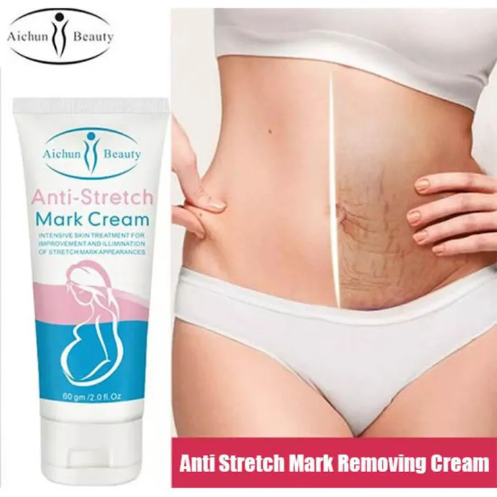 Anti Stretch Mark Cream