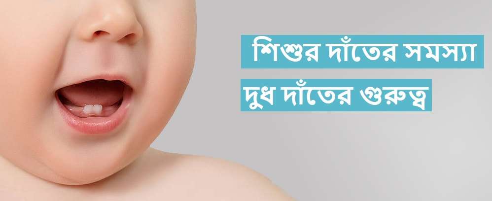 শিশুর দাঁতে সমস্যা: কারণ, লক্ষণ, প্রতিরোধ ও চিকিৎসা