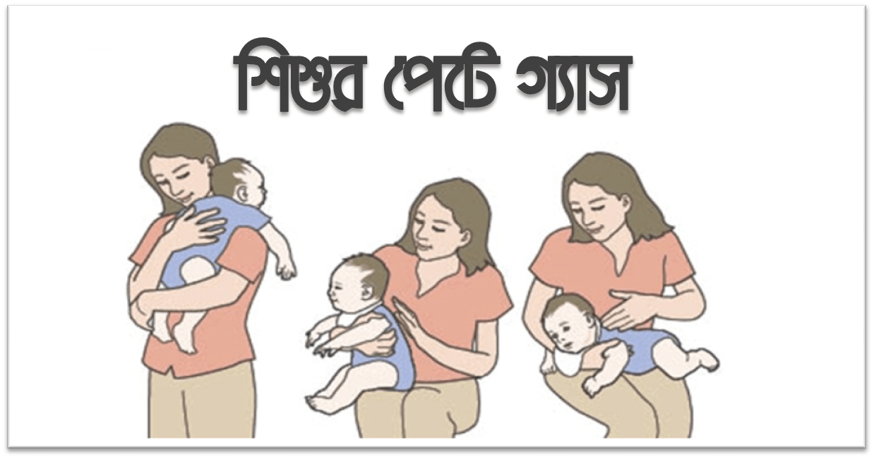 শিশুর পেটে গ্যাস: কারণ, লক্ষণ, প্রতিকার ও করণীয়