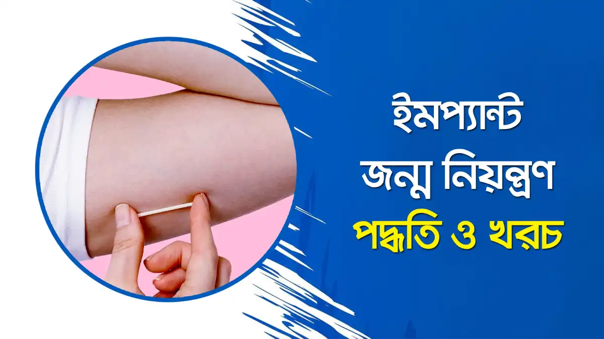 জন্মনিয়ন্ত্রন ইমপ্ল্যান্ট: ব্যবহার, কার্যকারিতা, সুবিধা ও পার্শ্বপ্রতিক্রিয়া