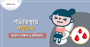 গর্ভাবস্থায় পাইলস: কারণ, উপসর্গ, চিকিৎসা ও প্রতিরোধ