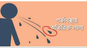 গর্ভাবস্থায় অতিরিক্ত লালা: কারণ, প্রতিকার ও ঘরোয়া যত্ন