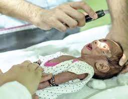 নবজাতকের চোখের সমস্যা: কারণ, লক্ষণ, চিকিৎসা ও প্রতিরোধ