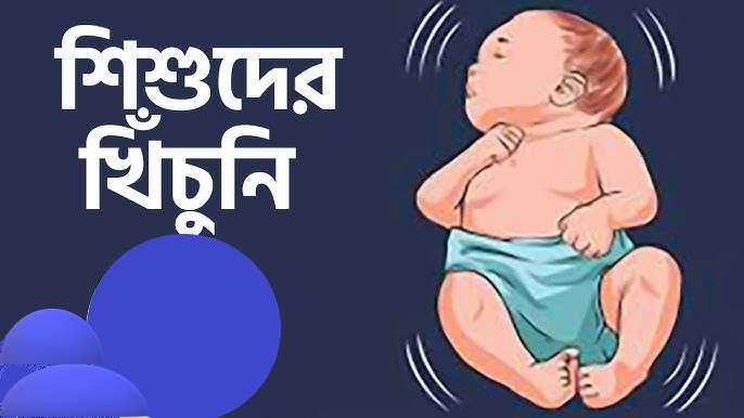 নবজাতক শিশুর খিঁচুনি: কারণ, লক্ষণ, চিকিৎসা ও প্রতিকার