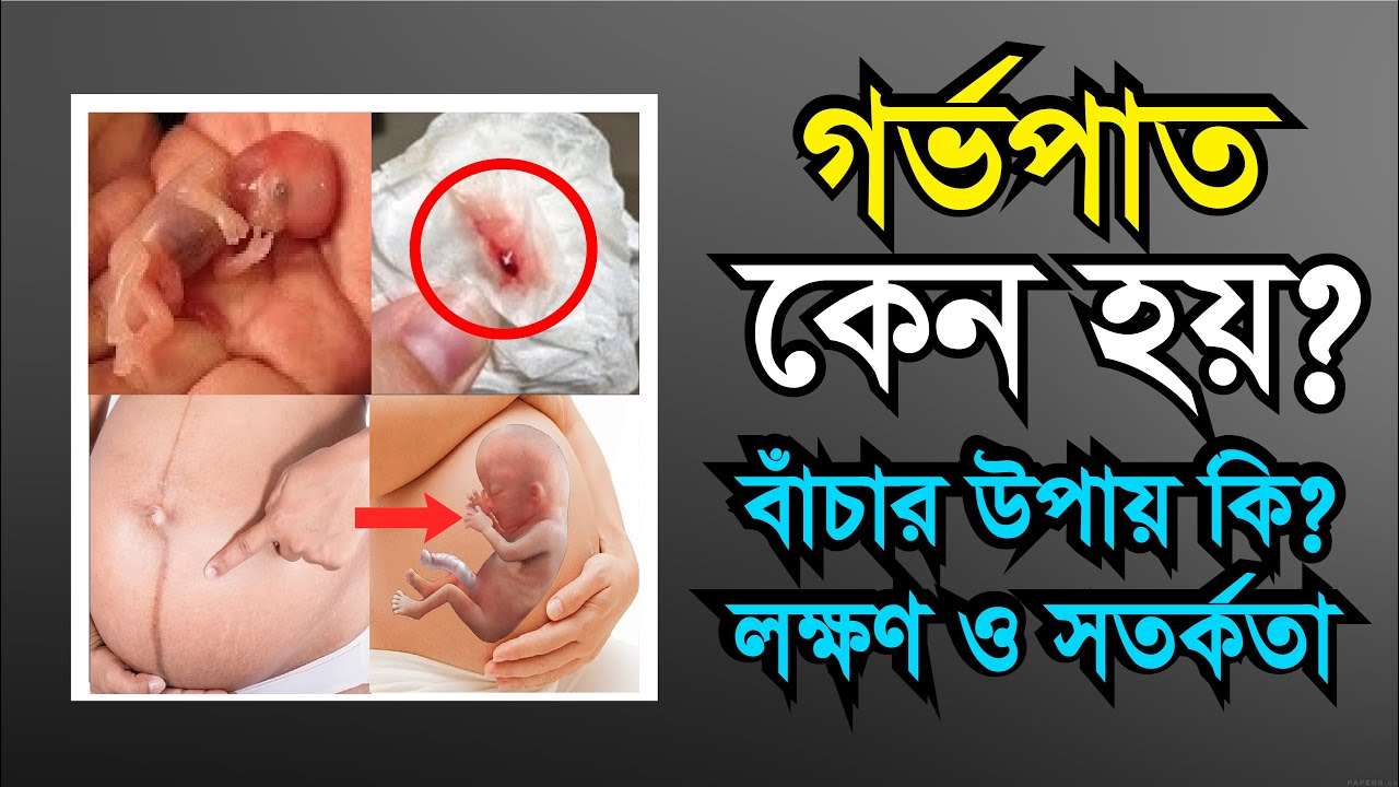 গর্ভপাত বা মিসক্যারেজ